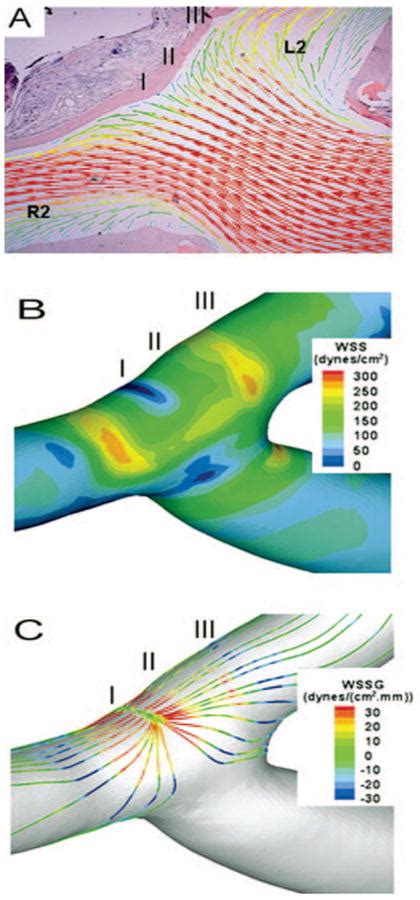 Image result for Multi Dynamic Vena Modeling