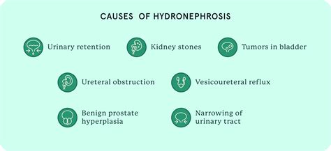 Causes Of Hydronephrosis