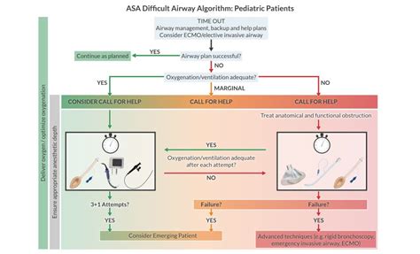 Image result for Difficult Airway Algorithm