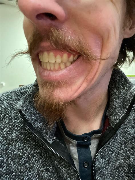 I Got Braces at 60 Years Old, and My Smile’s Never Looked Better Vector Art
