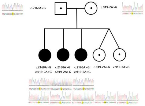 Atypical Presentation of Enlarged Vestibular Aqueducts Caused by ...