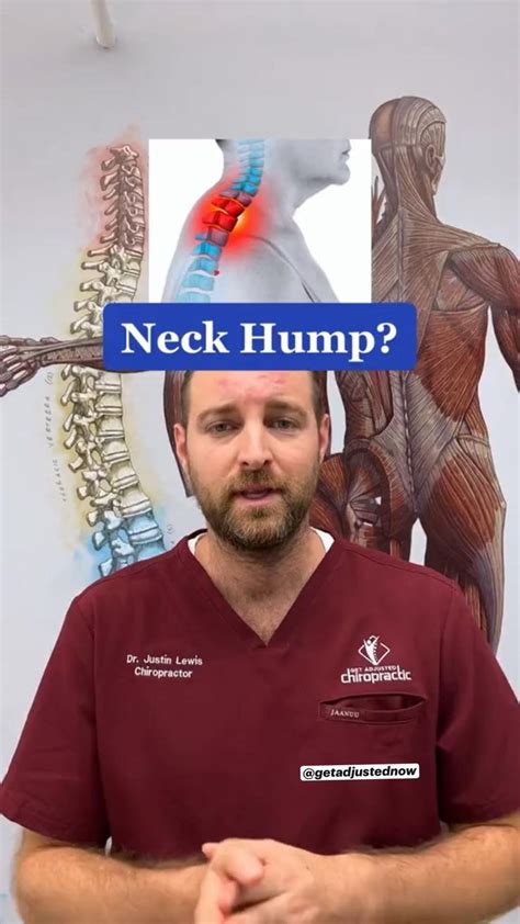 Image result for Forward Neck Position Tight Muscle Front