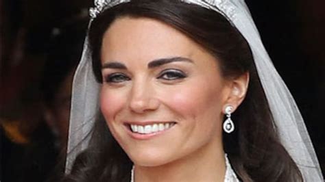 Kate Middleton's teeth deliberately unaligned - India Today