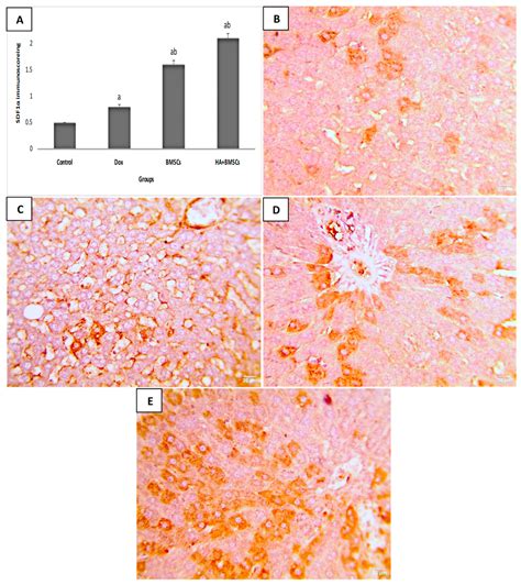 Hepatoprotective Effects of Hyaluronic Acid-Preconditioned Bone Marrow ...