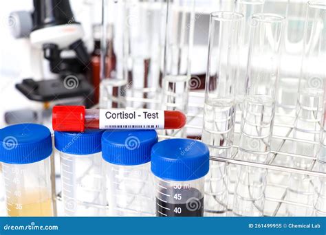 Cortisol Test To Look for Abnormalities from Blood Stock Image - Image of doctor, laboratory ...