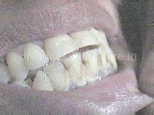 Dr. Saluja's family dental care centre|Dentist in Mumbai|Cosmetic ...