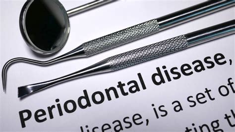 Does Periodontal Disease Go Away?