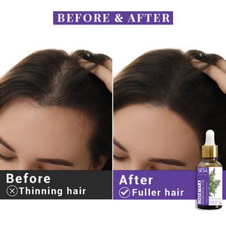 Sesa Rosemary Essential Oil – Sesa Care