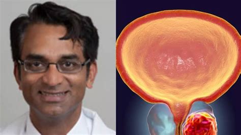 Indian Origin Doctor And His Team Find An Easy Way To Cure Prostate ...