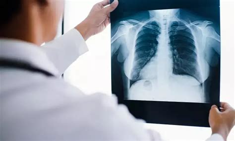 Single chest tube superior to double chest tube after decortication in ...