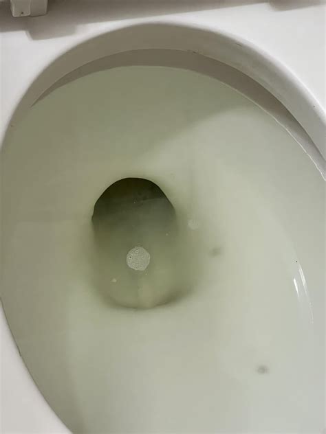 This is my urine about 4 minutes into the toilet bowl. About as clear as it gets, but those ...