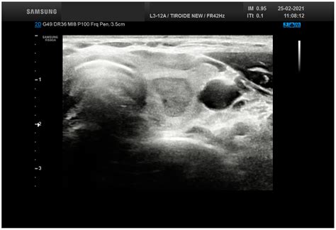 Overview of the Ultrasound Classification Systems in the Field of ...