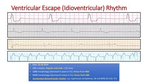 Complete EKG Interpretation Course | PPTX