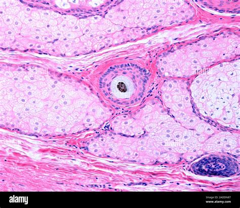 Sebaceous Glands Under Microscope