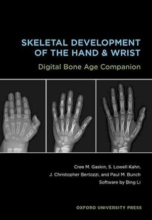 Buy Skeletal Development of the Hand and Wrist Digital Bone Age ...