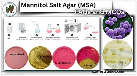 Mannitol Salt Agar (MSA) 50 FAQs and 30 MCQs | Lab Tests Guide