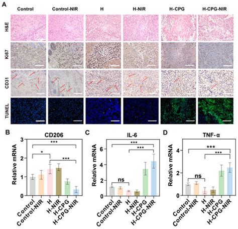 Multifunctional Nanocomposite Hydrogel with Enhanced Chemodynamic ...