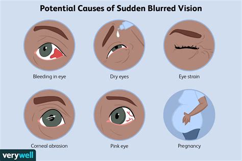 Image result for Sudden Vision Problems