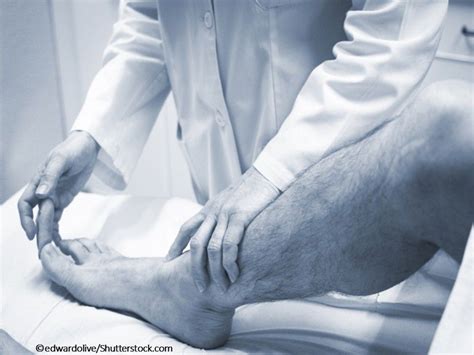 10 Questions About Gout: A Quiz | Rheumatology Network