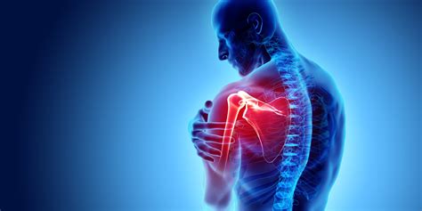Virtual Implant Positioning (VIP) used to heighten efficacy of shoulder ...