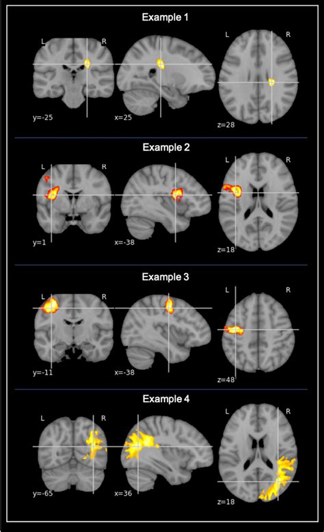 Frontiers | Predicting the Emergence of Major Neurocognitive Disorder ...
