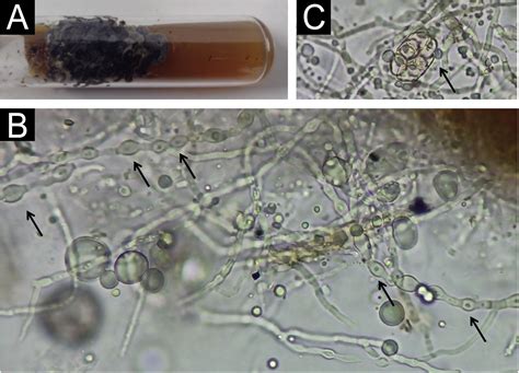 Piedraia hortae: biofilm formation and its importance in the ...