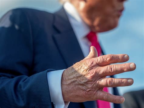 Las fotos que generaron preocupación por la salud de Donald Trump ...