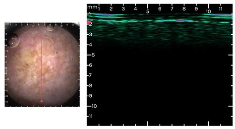 Digitally Enhanced Methods for the Diagnosis and Monitoring of ...