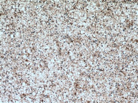 HOMER1 antibody (12433-1-AP) | Proteintech