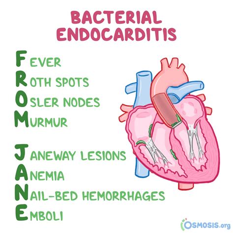 Endocarditis Symptoms