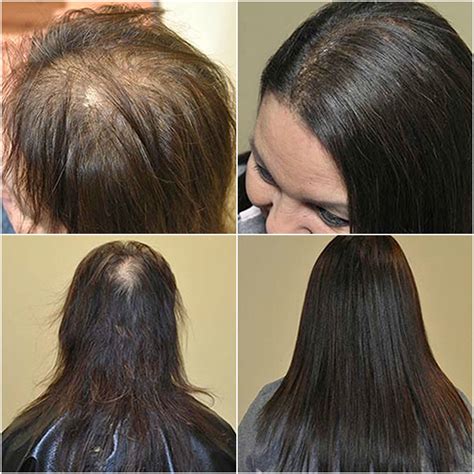 Hair Extensions for Thinning Hair – Di Biase Hair Extensions USA Store