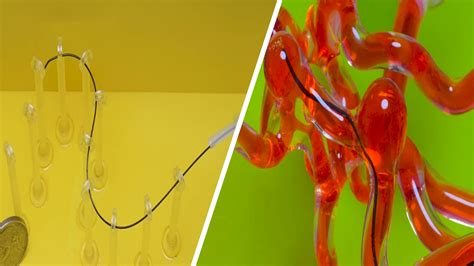 Robotic Thread 的图像结果