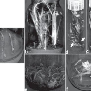 Image result for Tip Culture Methode Modification