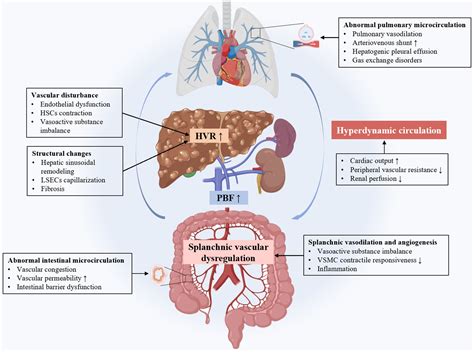 Portal Hypertension And Variceal Bleeding