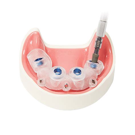 DIO Implant India Pvt Ltd - Global Leader in Dental Implant Innovation