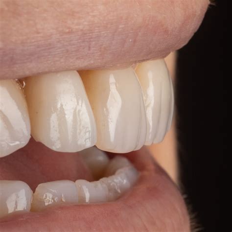 Image result for Injection Moulding