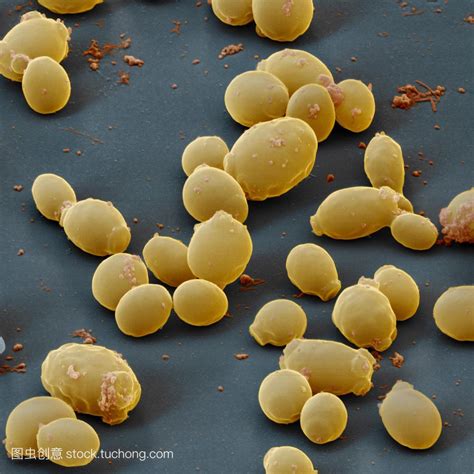 多彩的念珠菌--临床知识|克柔念珠菌|白念珠菌|酵母菌|培养基|-健康界