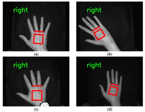 Fast and Accurate ROI Extraction for Non-Contact Dorsal Hand Vein ...