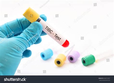 What Color Blood Tube For Ferritin at Randy Stambaugh blog