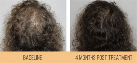 Image result for Reconstructing