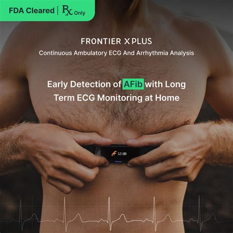 Frontier X Plus | FDA-Cleared Wearable ECG Monitor