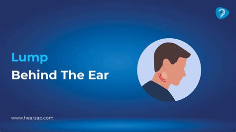 Lump Behind the Ear: Causes, Symptoms & Treatment