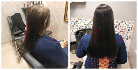 Hair Wigs in Sector 53 Gurgaon - Lynx Hair Skin C... | LYNX Hair Wigs ...