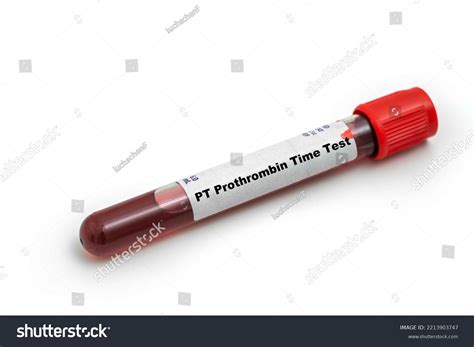 Pt Prothrombin Time Test Medical Check Stock Photo 2213903747 ...