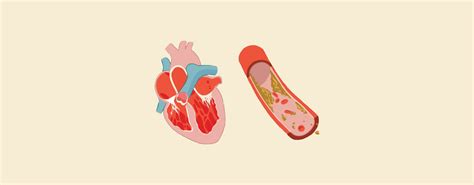 Difference between Cardiac Arrest and Heart Failure – Knya
