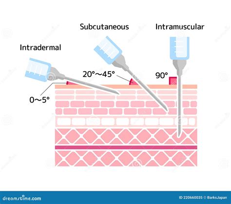 Angle of Injection 的图像结果