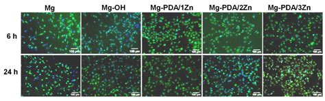 Fabrication of Zn2+-Loaded Polydopamine Coatings on Magnesium Alloy ...