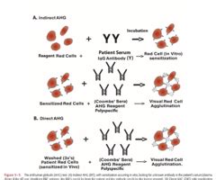 Image result for Dat vs Iat