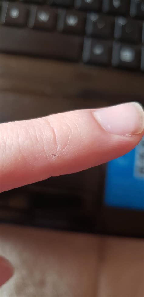 One of my beard hairs was sharp and strong enough to stab through the ...