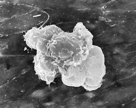 Image result for Monocyte Electron Microscope